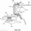 Fig. 135 - METHOD FOR TISSUE TREATMENT BY SURGICAL INSTRUMENT