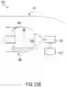 Fig. 150 - METHOD FOR TISSUE TREATMENT BY SURGICAL INSTRUMENT