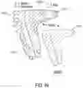Fig. 52 - METHOD FOR TISSUE TREATMENT BY SURGICAL INSTRUMENT