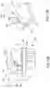 Fig. 66 - METHOD FOR TISSUE TREATMENT BY SURGICAL INSTRUMENT