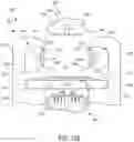 Fig. 67 - METHOD FOR TISSUE TREATMENT BY SURGICAL INSTRUMENT