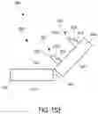 Fig. 84 - METHOD FOR TISSUE TREATMENT BY SURGICAL INSTRUMENT