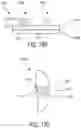 Fig. 93 - METHOD FOR TISSUE TREATMENT BY SURGICAL INSTRUMENT