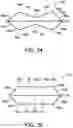 Fig. 22 - Electrode assembly for catheter system
