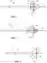 Fig. 03 - INTRACARDIAC TOOLS AND METHODS FOR DELIVERY OF ELECTROPORATION THERAPIES