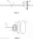 Fig. 04 - INTRACARDIAC TOOLS AND METHODS FOR DELIVERY OF ELECTROPORATION THERAPIES