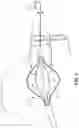 Fig. 06 - INTRACARDIAC TOOLS AND METHODS FOR DELIVERY OF ELECTROPORATION THERAPIES