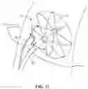 Fig. 10 - INTRACARDIAC TOOLS AND METHODS FOR DELIVERY OF ELECTROPORATION THERAPIES
