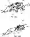 Fig. 152 - Systems and methods for positioning an elongate member inside a body