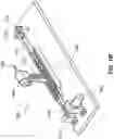 Fig. 155 - Systems and methods for positioning an elongate member inside a body