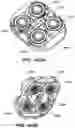 Fig. 188 - Systems and methods for positioning an elongate member inside a body