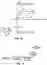 Fig. 25 - Systems and methods for positioning an elongate member inside a body