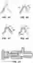 Fig. 51 - Systems and methods for positioning an elongate member inside a body