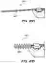 Fig. 83 - Systems and methods for positioning an elongate member inside a body