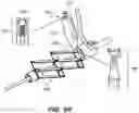 Fig. 93 - Systems and methods for positioning an elongate member inside a body