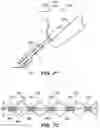 Fig. 95 - Systems and methods for positioning an elongate member inside a body