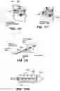 Fig. 98 - Systems and methods for positioning an elongate member inside a body