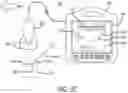 Fig. 08 - Ultrasound probe with target tracking capability