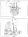 Fig. 22 - Augmented Reality Assisted Navigation of Knee Replacement