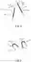 Fig. 05 - Method of controlling surgical system and surgical system
