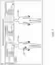 Fig. 08 - MEDICAL IMPLANT TRACKING SYSTEM