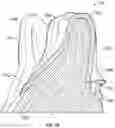 Fig. 04 - REMOVABLE DENTAL APPLIANCES INCLUDING BENDABLE FLAPS AND ARCUATE MEMBERS