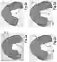 Fig. 03 - METHOD FOR GRAPHICALLY PRESENTING A PLURALITY OF SCANS