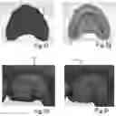 Fig. 07 - METHOD FOR GRAPHICALLY PRESENTING A PLURALITY OF SCANS
