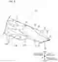 Fig. 05 - TUBULAR INDWELLING DEVICE