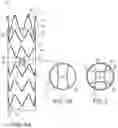 Fig. 02 - Stent graft with fenestration lock and methods of use