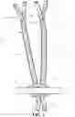 Fig. 04 - Dynamic ligament repair device