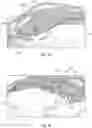 Fig. 02 - PROSTHETIC HEART VALVES