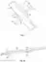 Fig. 05 - PROSTHETIC HEART VALVES