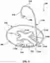 Fig. 06 - Prolapse prevention device and methods of use thereof