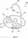 Fig. 08 - Prolapse prevention device and methods of use thereof