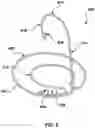 Fig. 09 - Prolapse prevention device and methods of use thereof