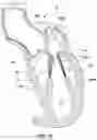 Fig. 13 - Prolapse prevention device and methods of use thereof