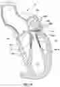 Fig. 15 - Prolapse prevention device and methods of use thereof