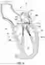 Fig. 17 - Prolapse prevention device and methods of use thereof