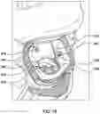 Fig. 18 - Prolapse prevention device and methods of use thereof