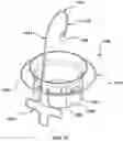 Fig. 20 - Prolapse prevention device and methods of use thereof