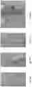 Fig. 19 - Bioabsorbable textiles and methods for joint function restoration