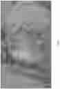 Fig. 25 - Bioabsorbable textiles and methods for joint function restoration