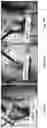 Fig. 27 - Bioabsorbable textiles and methods for joint function restoration