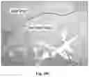 Fig. 31 - Bioabsorbable textiles and methods for joint function restoration