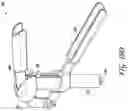 Fig. 19 - Implant introducer