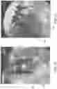 Fig. 28 - Methods of designing high x-ray lucency lattice structures
