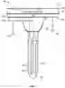 Fig. 02 - KNEE REPLACEMENT IMPLANT HAVING STACKABLE SPACERS