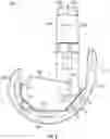 Fig. 03 - KNEE REPLACEMENT IMPLANT HAVING STACKABLE SPACERS