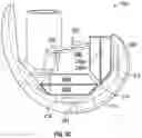Fig. 06 - KNEE REPLACEMENT IMPLANT HAVING STACKABLE SPACERS